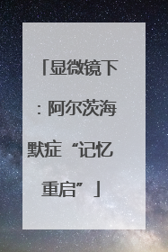 显微镜下：阿尔茨海默症“记忆重启”